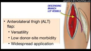 The anterolateral thigh (ALT) flap is a workhorse flap for a variety of wounds