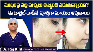 ముఖంపై నల్ల మచ్చలు పోవాలంటే || How to Reduce Dark Spots on Face || Celestee Skin And Hair Clinic