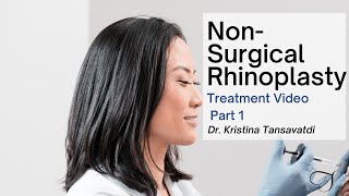 Dr. Kristina Tansavatdi | Non-Surgical Rhinoplasty | Part 1 of 2