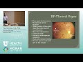 retinal and macular dystrophies