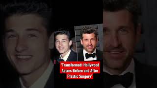 Transformed: Hollywood Actors Before and After Plastic Surgery