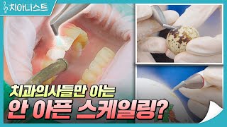 시린이에도 끄떡없는 스케일링? 아프지 않고 시리지 않은 스케일링이 있다면? 😁🦷