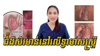 ជំងឺ សិរមាន់នៅទ្វារមាសស្រ្តី