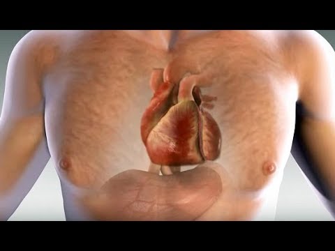 If You Follow This Diet You Can Never Have a Heart Attack If You Follow This Diet You Can Never Have a Heart Attack