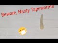 REAL MOVING TAPEWORM!!!! informative Video! REAL MOVING TAPEWORM!!!! informative Video!