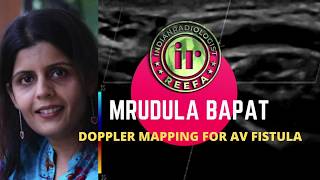 TMT: Doppler Mapping for AV Fistula by Dr Mrudula Bapat