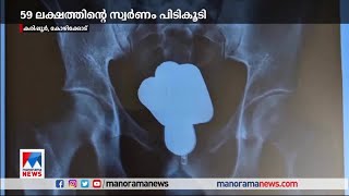 കരിപ്പൂരില്‍ വന്‍ സ്വര്‍ണവേട്ട; പിടികൂടിയത് 59 ലക്ഷത്തിന്റെ സ്വര്‍ണം | Karipur | Gold Smuggling