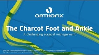 The Charcot Foot and Ankle - A challenging surgical management