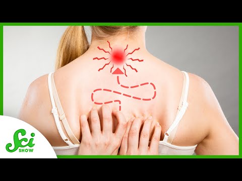 What is an itch and how does it pertain to the nervous system?