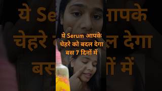 ये Serum आपके चेहरे से काले धब्बे को बस 7 दिनो गायब कर देगा ! #vitamincserum #youtube #shorts