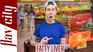 Top 10 Foods For Reversing FATTY LIVER DISEASE...And What To Avoid!
