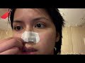 trying bioré the original deep cleansing pore strips rose clare fernandez