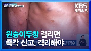 오늘 원숭이두창 2급 감염병 고시…3세대 백신 도입 착수 / KBS  2022.06.08.