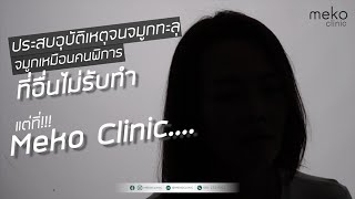 แก้จมูกทะลุ เคสยากปราบเซียน โดยคุณหมอแพร Meko clinic