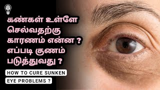 How To Cure Sunken Eye Problems In Tamil | தமிழ் | Empty Idea