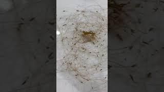 Picking a thousand of lice on hair How to get rid of lice #hair #wigs  #lice #shorts