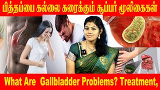 பித்தப்பை கல்லை கரைக்கும் சூப்பர் மூலிகைகள் | What Are  Gallbladder Problems? Treatment,