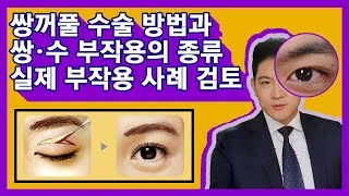 #쌍꺼풀수술부작용 #수술비환불 실제 쌍커풀수술 부작용 환자 사례 검토