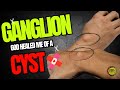 #testimony GOD HEALED ME OF A GANGLION CYST|HEALING AND DELIVERANCE PRAYERS