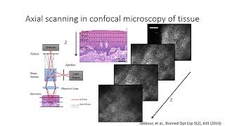 Kristen Maitland - Multimodal Optical Imaging for Early Detection of Oral Cancer