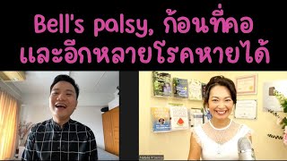 ชาวไทยใหญ่กำจัดโรคหน้าเบี้ยวครึ่งซีก Bell's palsy ก้อนที่คอ และอีกหลายโรค ด้วยตัวเอง