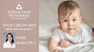 Common skin conditions in children.