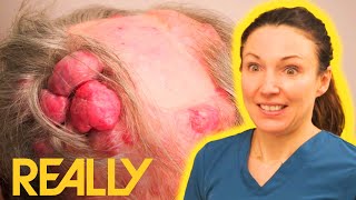 “It’s Like An Alien Monster!” Man Lives With Multiple LUMPS On His Head | The Bad Skin Clinic