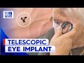 Telescopic eye implant enables woman to see family again | 9 News Australia