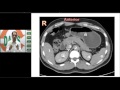 #USMLE #DAMS #STEP1 #ANATOMY #INTEGRATED #PULMONARY #EMBOLISM