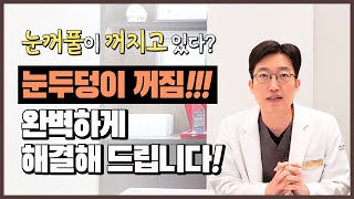 [닥터플래너 tv] 꺼진 눈두덩이가 고민일 때는? 퀭~한 인상의 주범 눈꺼풀꺼짐