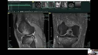 Looking Inside Your Knee at Atlantic Medical Imaging