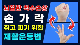 뇌경색 뇌출혈 모든뇌질환 척수손상 재활운동방법-손가락 쥐고 피기위한 재활운동법-Stroke finger closing  piggy rehabilitation exercise