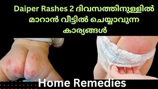 Diaper Rashes On baby Malayalam|Home remedies|H4 Health