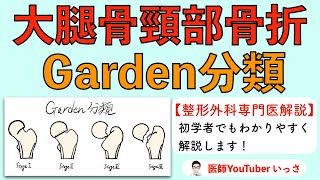 大腿骨頸部骨折　Garden分類　【整形外科専門医解説】