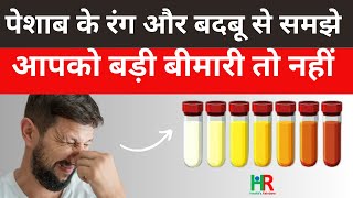 urine  color and bed smell problem | पेशाब में बदबू क्यों आती है | पेशाब पीला क्यों है |