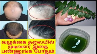 சொட்டை (வழுக்கை)  தலையிலும் முடி வேகமாக வளரும் | hair fall control fast hair growth tips