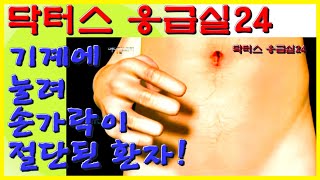 헐... 끔찍한 사고 현장 ㅠ.ㅜ 공장 기계에 눌려 손가락이 절단 된 환자! | 닥터스 응급실24 응급의학과 의사 119 구급대원 의학 다큐 다시보기