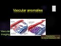 4-Vascular anomalies