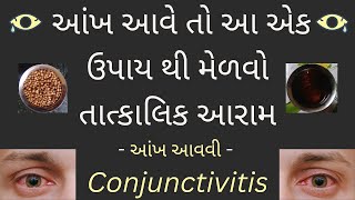 આંખ આવવી || આંખ આવે તો શું કરવું || આંખ માં બળતરા નો ઈલાજ || Conjunctivitis Ayurved Treatment