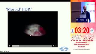 AIOC2022 IC533 topic Dr Gagan Bhatia MORBID PROLIFERATIVE DIABETIC RETINOPATHY