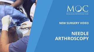 Surgery Video: Needle Arthroscopy