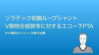 ソラテック人工血管内シャント狭窄に対するエコーガイド下PTA