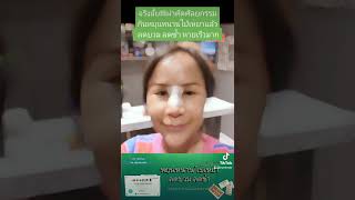 รีวิวเสริมจมูก ทานหยุนหนานไป๋เหยาก่อนผ่าตัด ลดบวมลดช้ำเร็ว