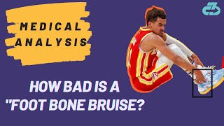 Expert Explains Trae Young Injury (Foot Bone Bruise) \u0026 Availability