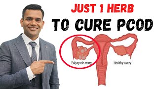 Just 1 Teaspoon Per Day To Cure PCOD/PCOS & Irregular Periods Permanently