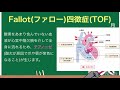 循環器疾患学（先天性心疾患②）　18時間目「作業療法士（ot）の為の国家試験対策」