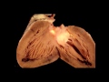 Normal Anatomy of the Heart