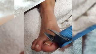 Gespecialiseerde pedicure