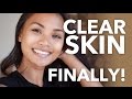 Eczema to FLAWLESS skin (my story!)