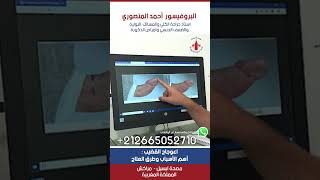 اعوجاج القضيب : أهم الأسباب وطرق العلاج